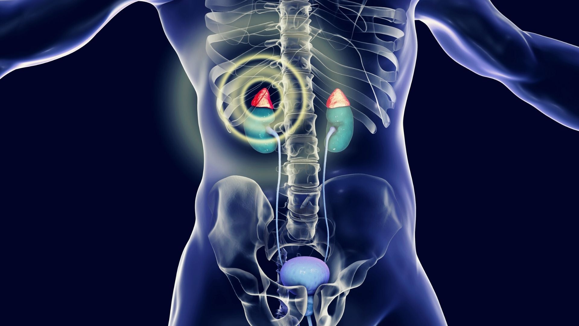 Tumor de Adrenal